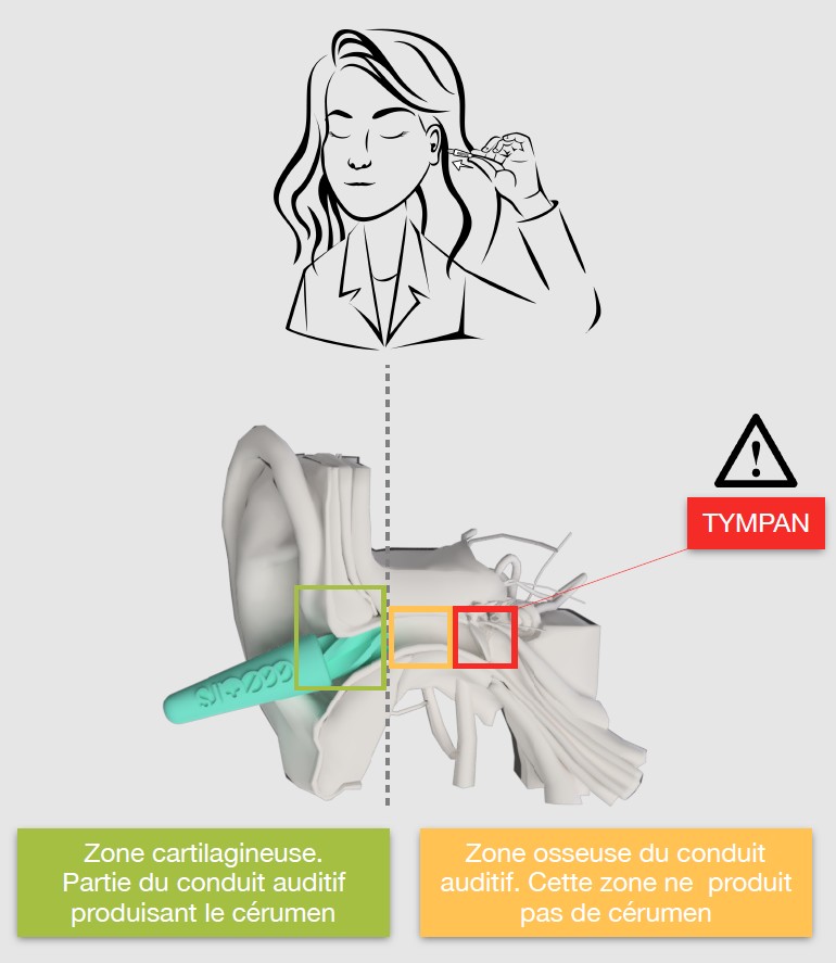 Les avantages de l'utilisation du nettoyeur d'oreilles réutilisable eeears  